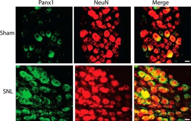 Pannexin 1 Antibody in Immunohistochemistry (IHC)