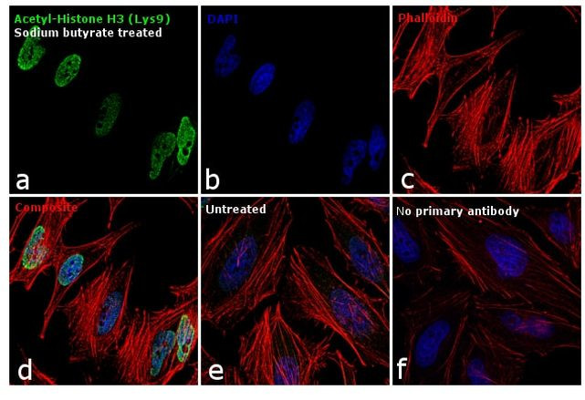 H3K9ac Antibody in Immunocytochemistry (ICC/IF)