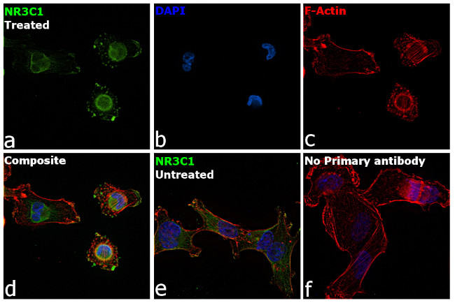 Glucocorticoid Receptor Antibody in Immunocytochemistry (ICC/IF)