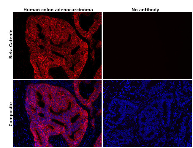 beta Catenin Antibody in Immunohistochemistry (Paraffin) (IHC (P))