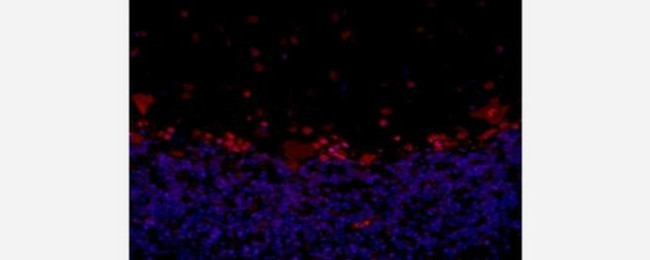 Musashi-2 Antibody in Immunohistochemistry (Paraffin) (IHC (P))