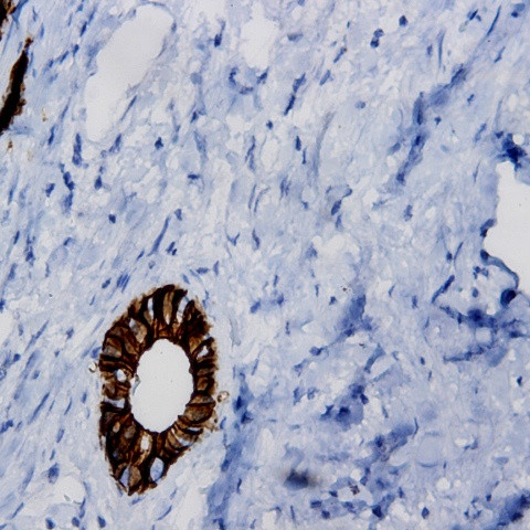 FGFR-3 Antibody in Immunohistochemistry (PFA fixed) (IHC (PFA))