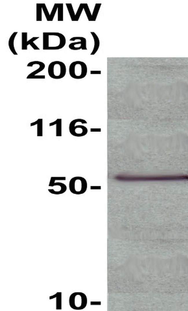 Phospho-NF-kB p65 (Ser536) Antibody in Western Blot (WB)