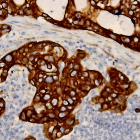 Cytokeratin 14 Antibody in Immunohistochemistry (Paraffin) (IHC (P))