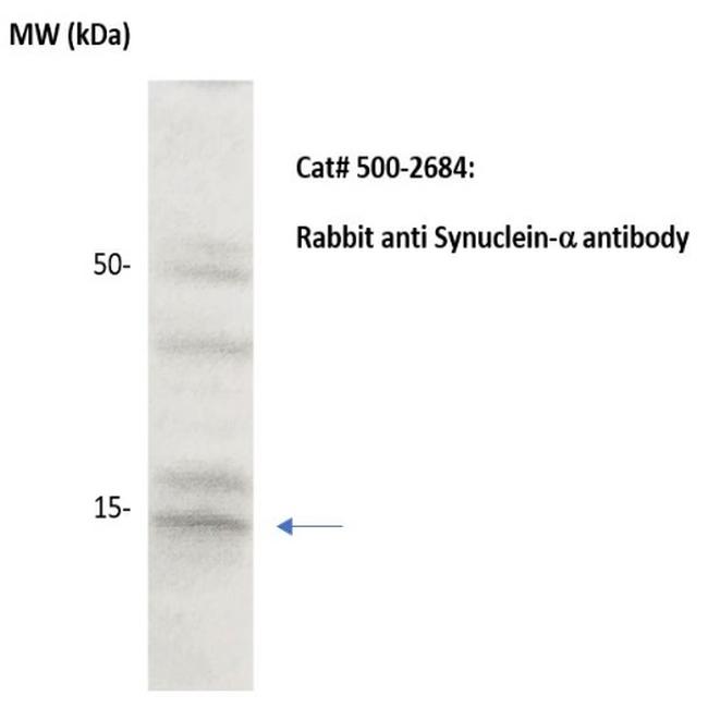 Synuclein alpha Antibody in Western Blot (WB)