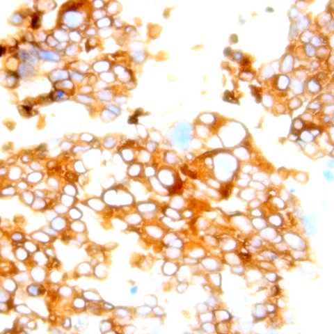 Claudin 4 Antibody in Immunohistochemistry (Paraffin) (IHC (P))