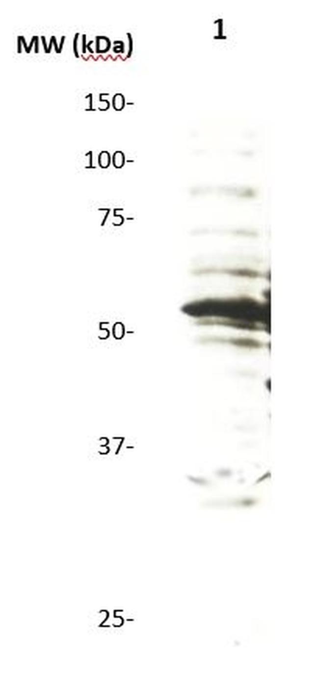 p57 /Kip2 Antibody in Western Blot (WB)