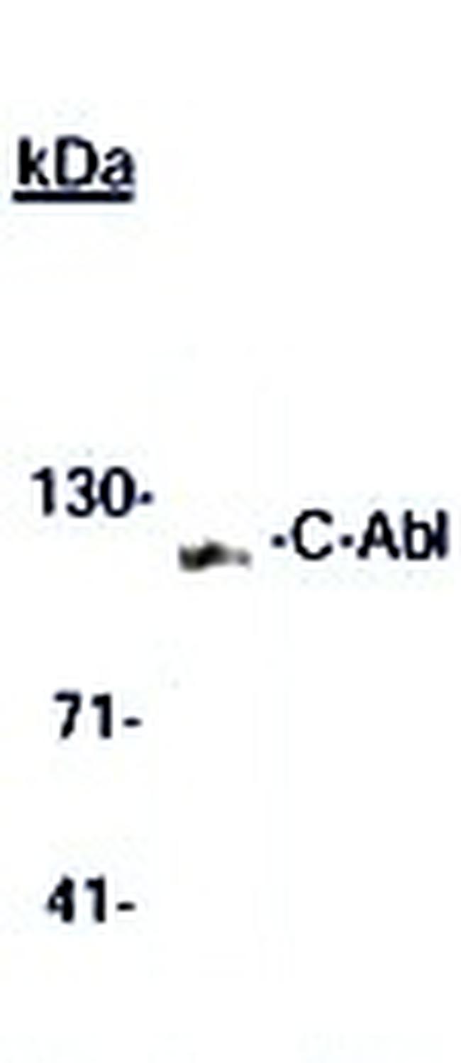 c-Abl Antibody in Western Blot (WB)