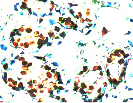 STAT5 Antibody in Immunohistochemistry (Paraffin) (IHC (P))