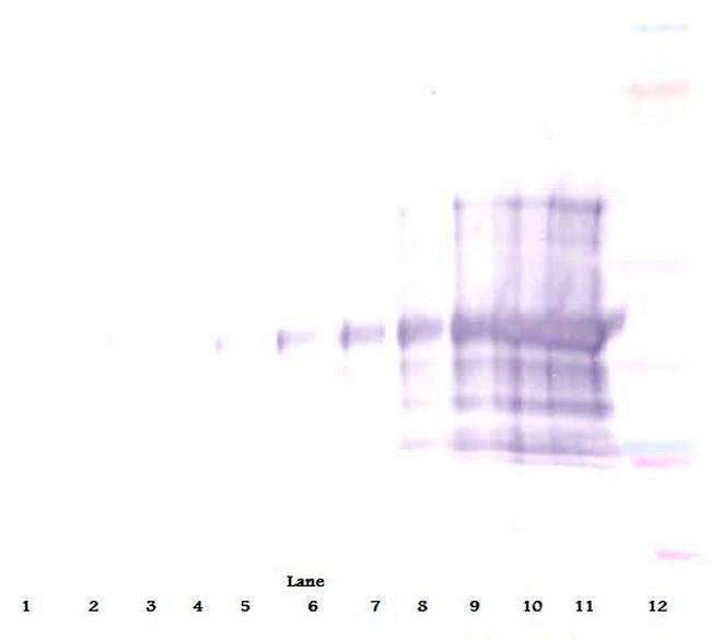 CD25 (soluble) Antibody in Western Blot (WB)