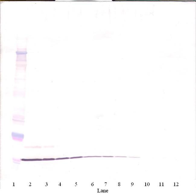 MIP-3 alpha Antibody in Western Blot (WB)