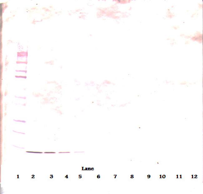 beta-NGF Antibody in Western Blot (WB)