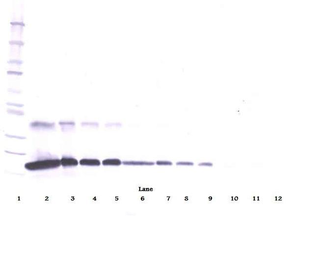 TNFR1 (soluble) Antibody in Western Blot (WB)