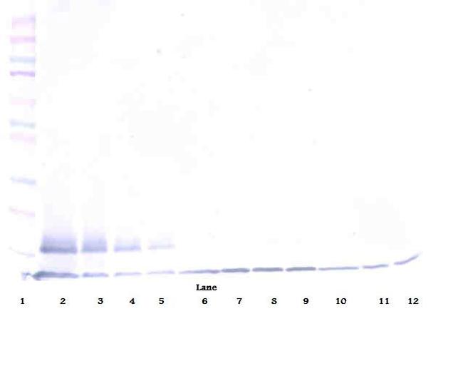 TRAIL-R2 (DR5) (soluble) Antibody in Western Blot (WB)