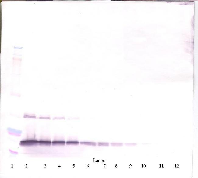 G-CSF Antibody in Western Blot (WB)
