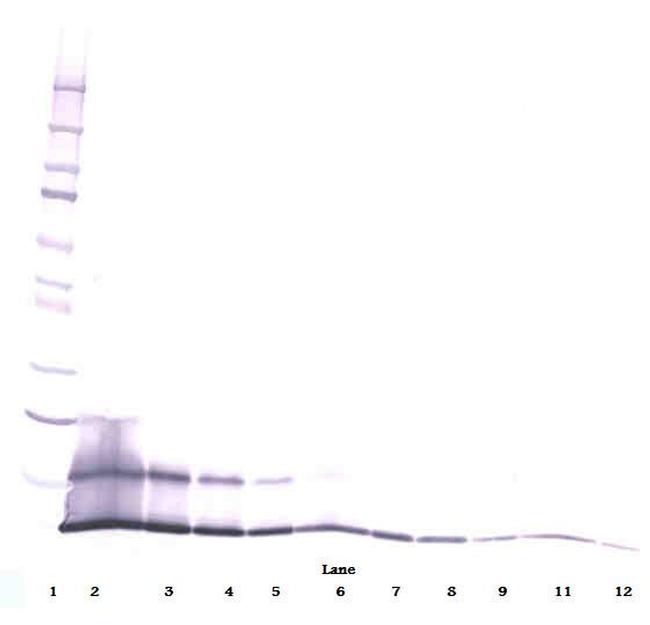 CCL5 (RANTES) Antibody in Western Blot (WB)