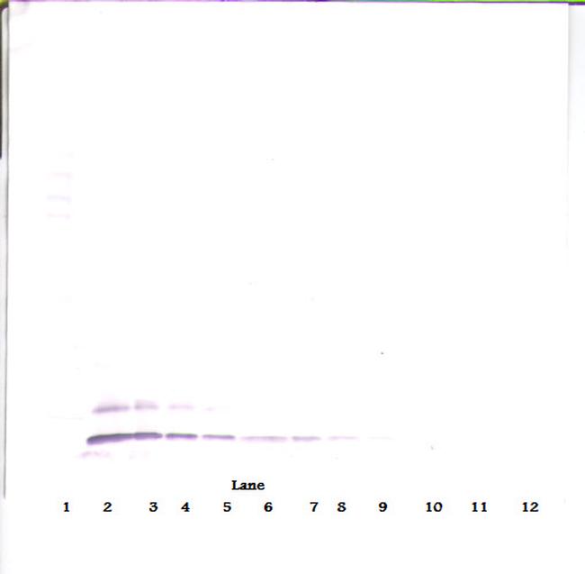 TARC Antibody in Western Blot (WB)