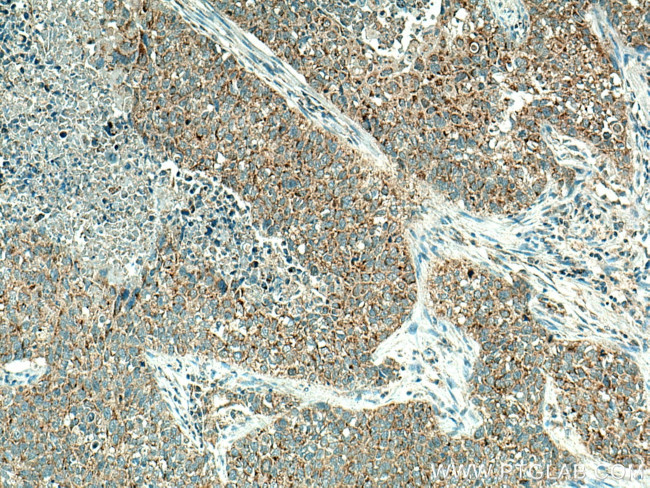 BCL10 Antibody in Immunohistochemistry (Paraffin) (IHC (P))