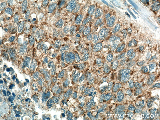 BCL10 Antibody in Immunohistochemistry (Paraffin) (IHC (P))