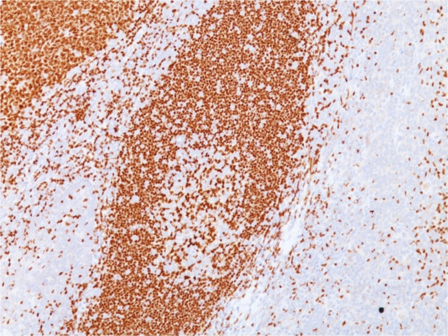 PAX5/BSAP Antibody in Immunohistochemistry (Paraffin) (IHC (P))