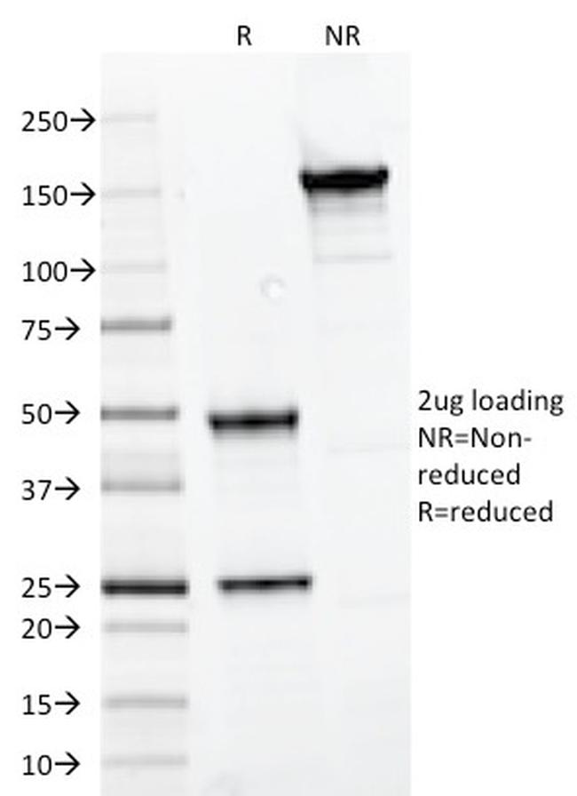 PAX7 Antibody in SDS-PAGE (SDS-PAGE)
