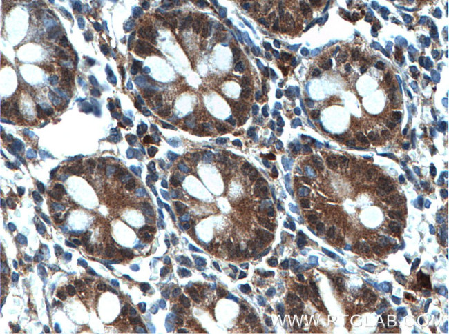 SPTLC2 Antibody in Immunohistochemistry (Paraffin) (IHC (P))