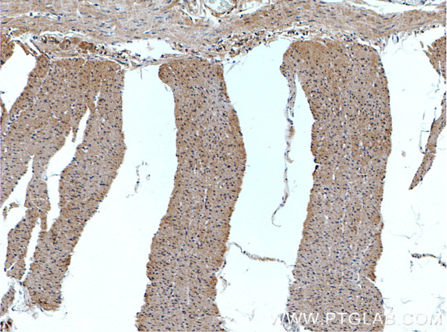 SPTLC2 Antibody in Immunohistochemistry (Paraffin) (IHC (P))