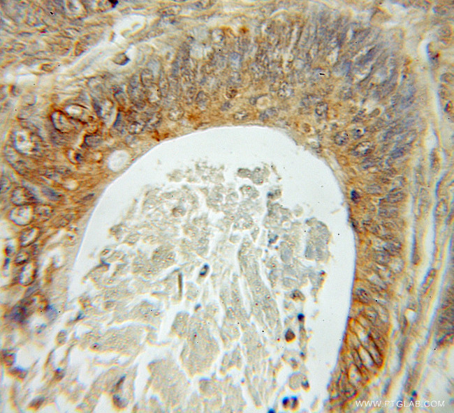 Fhl1 Antibody in Immunohistochemistry (Paraffin) (IHC (P))