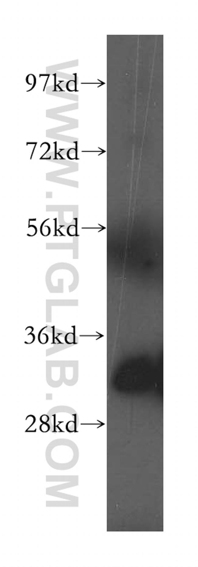 Fhl1 Antibody in Western Blot (WB)