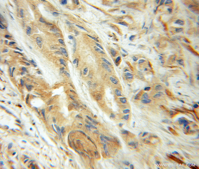 UBC9 Antibody in Immunohistochemistry (Paraffin) (IHC (P))