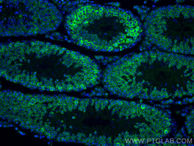 DDX4/VASA Antibody in Immunohistochemistry (PFA fixed) (IHC (PFA))