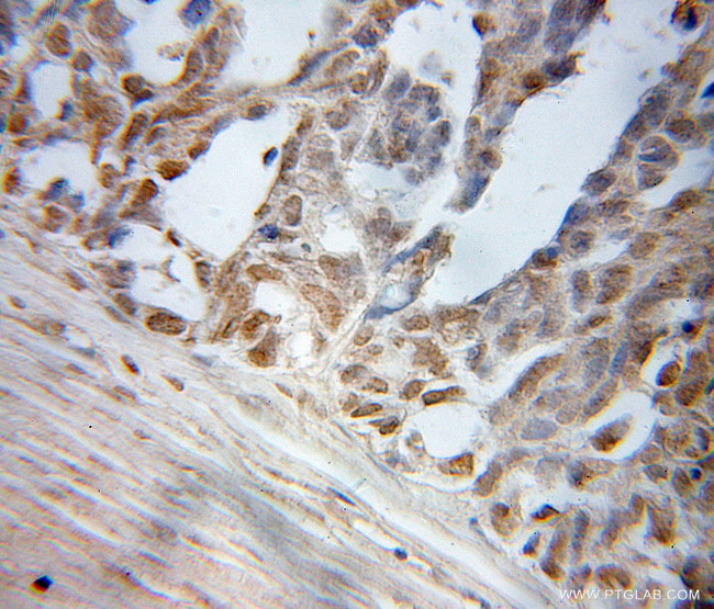 ELL Antibody in Immunohistochemistry (Paraffin) (IHC (P))