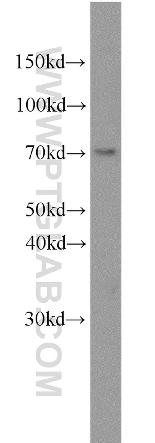 ELL Antibody in Western Blot (WB)