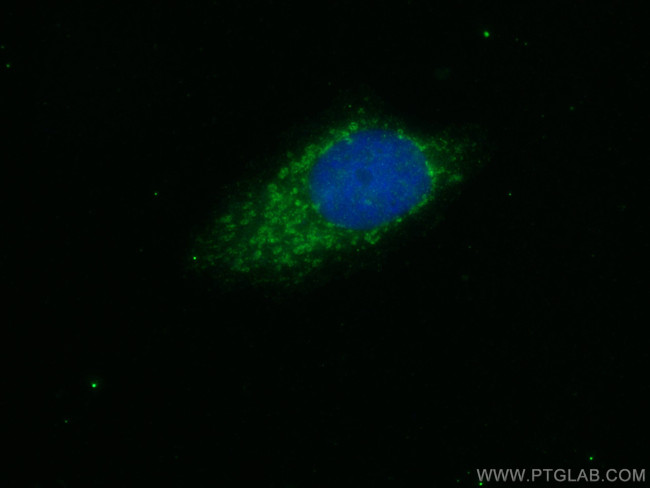 SIK1 Antibody in Immunocytochemistry (ICC/IF)