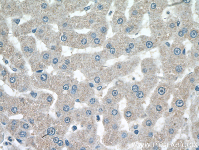 SIK1 Antibody in Immunohistochemistry (Paraffin) (IHC (P))