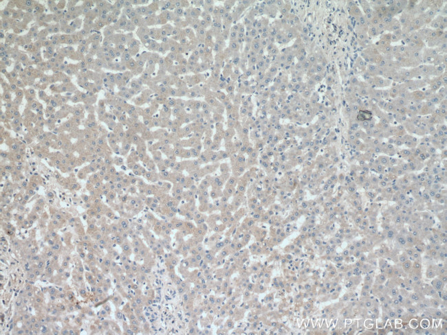 SIK1 Antibody in Immunohistochemistry (Paraffin) (IHC (P))