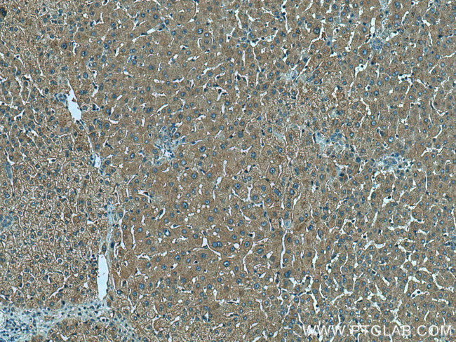 SIK1 Antibody in Immunohistochemistry (Paraffin) (IHC (P))