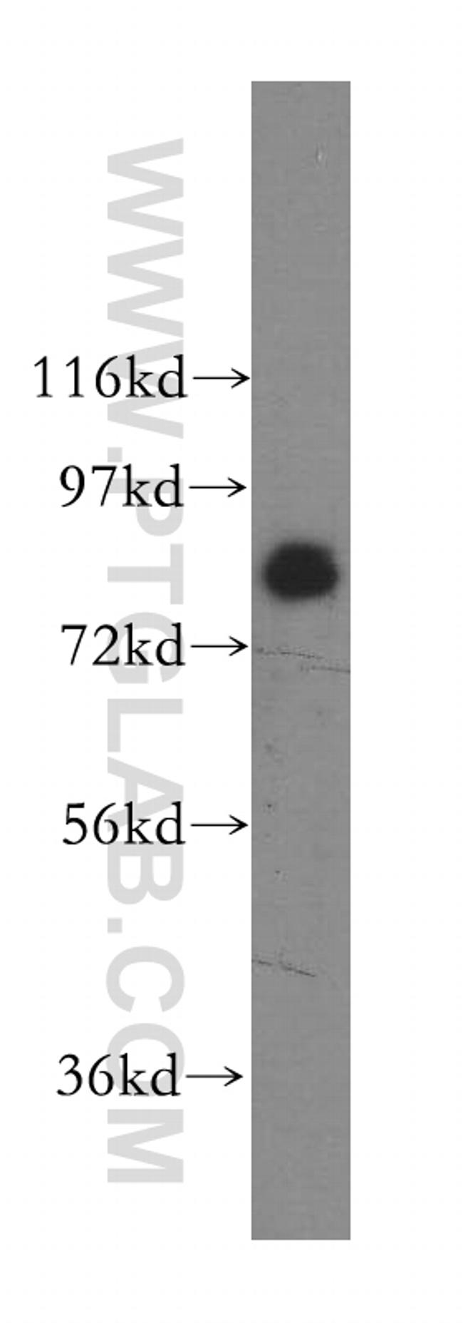 SIK1 Antibody in Western Blot (WB)