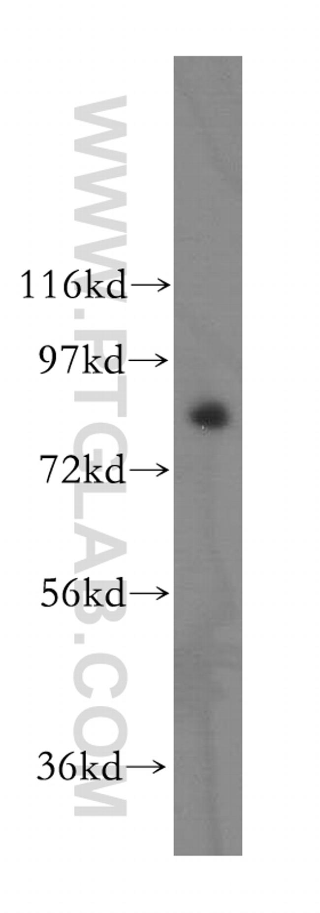 SIK1 Antibody in Western Blot (WB)