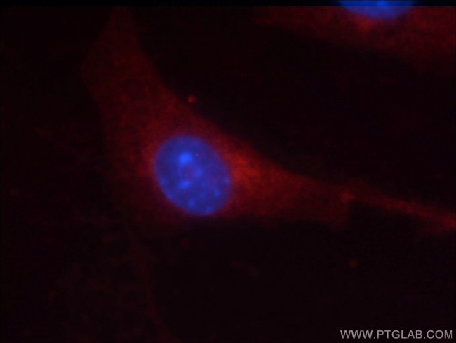 GSK3B Antibody in Immunocytochemistry (ICC/IF)