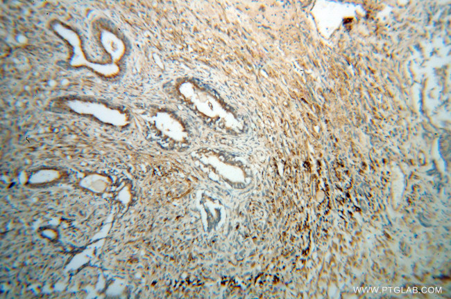 GSK3B Antibody in Immunohistochemistry (Paraffin) (IHC (P))