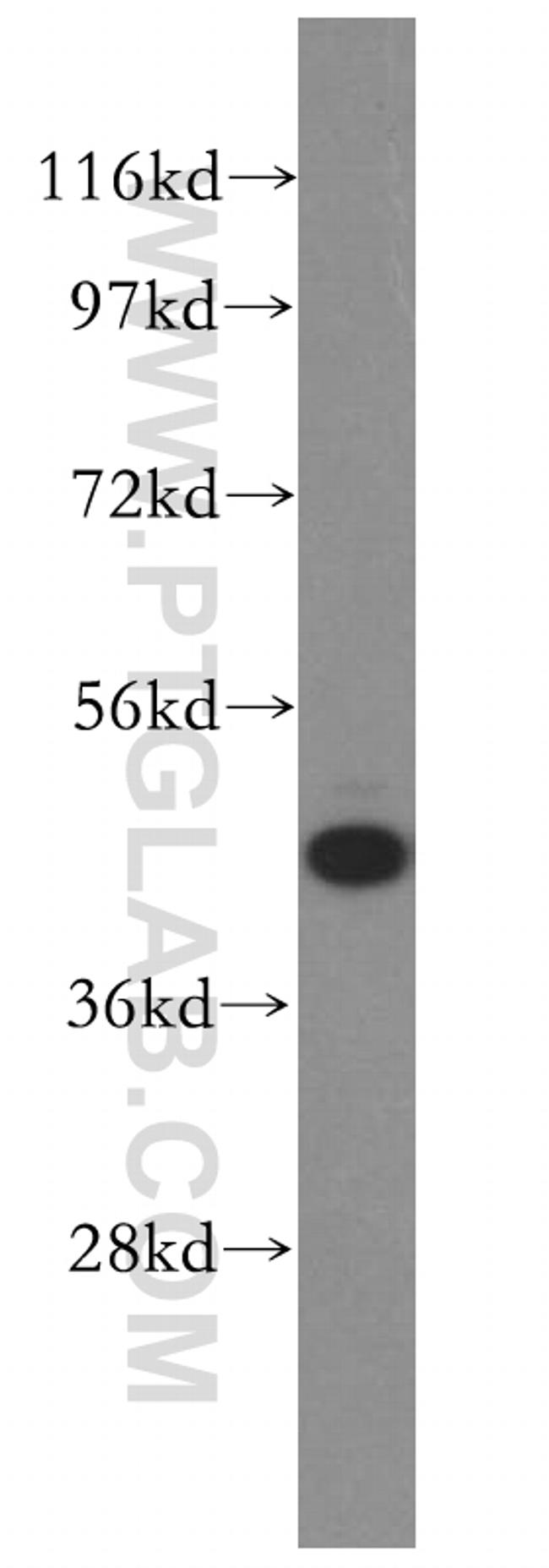 GSK3B Antibody in Western Blot (WB)