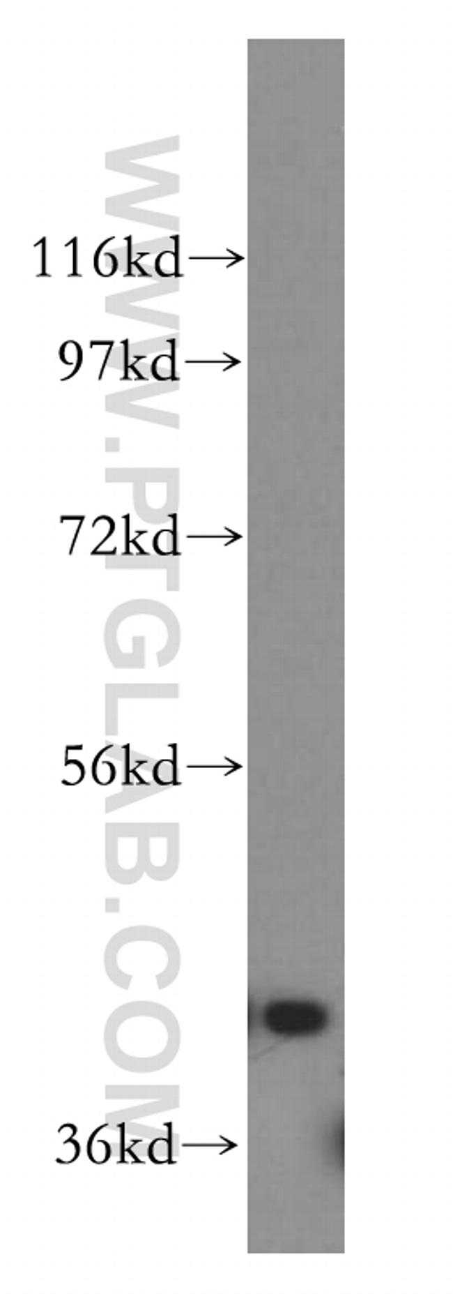 GSK3B Antibody in Western Blot (WB)