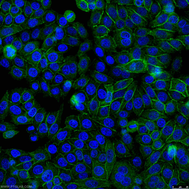 beta-Catenin Antibody in Immunocytochemistry (ICC/IF)