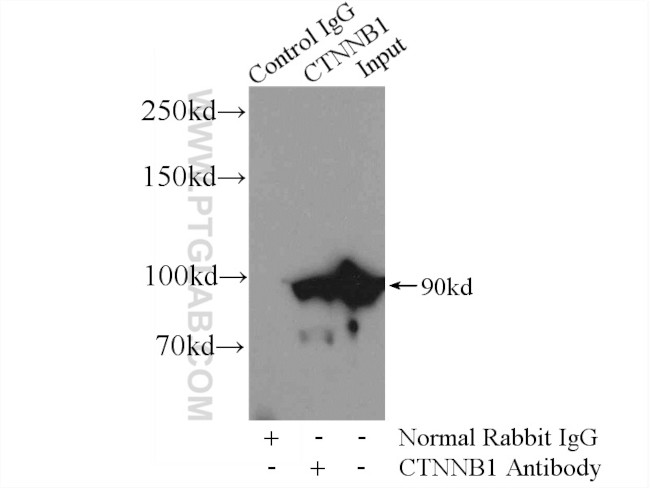 beta-Catenin Antibody in Immunoprecipitation (IP)