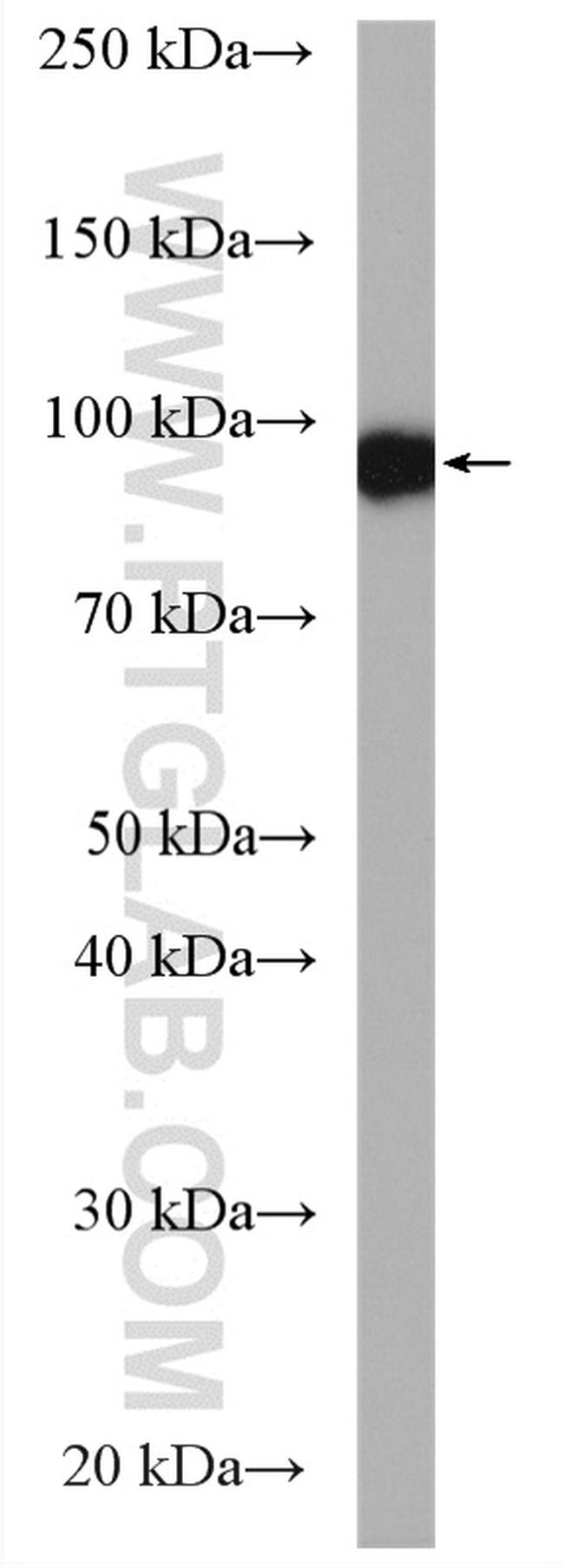 beta-Catenin Antibody in Western Blot (WB)