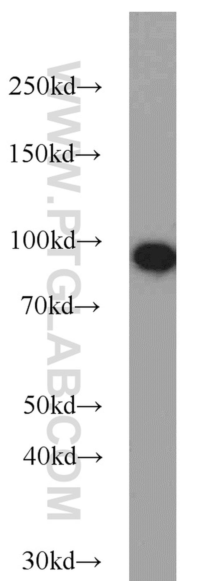 beta-Catenin Antibody in Western Blot (WB)