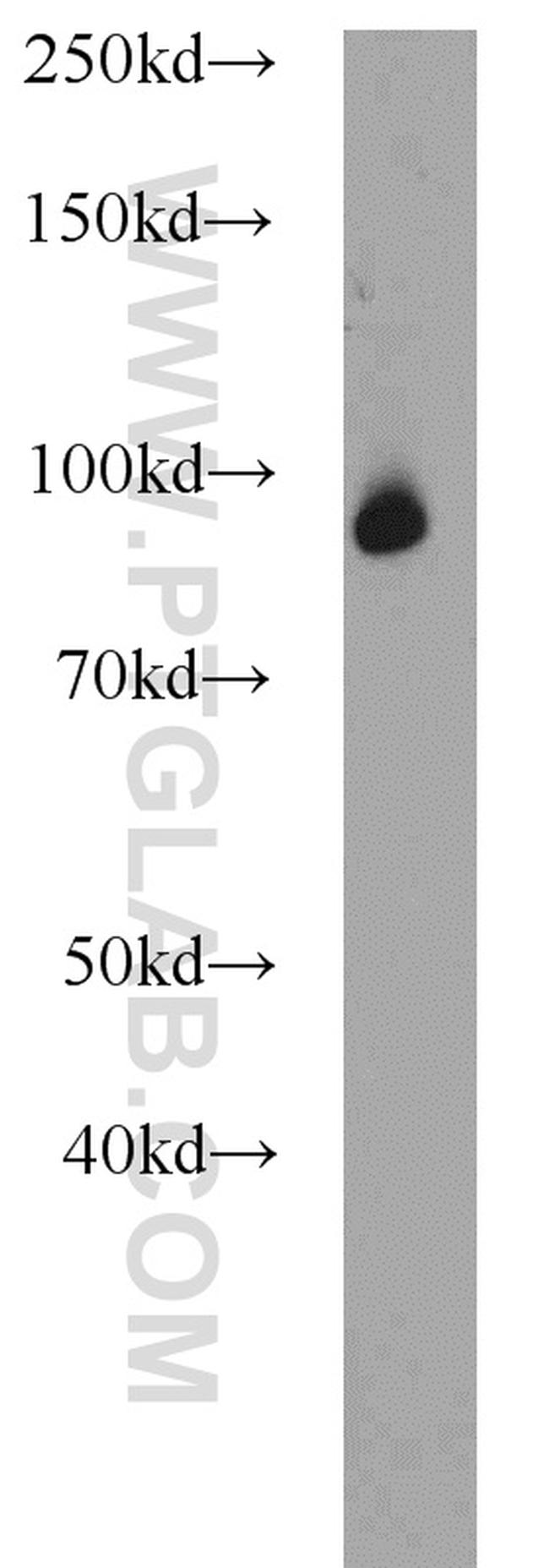 beta-Catenin Antibody in Western Blot (WB)