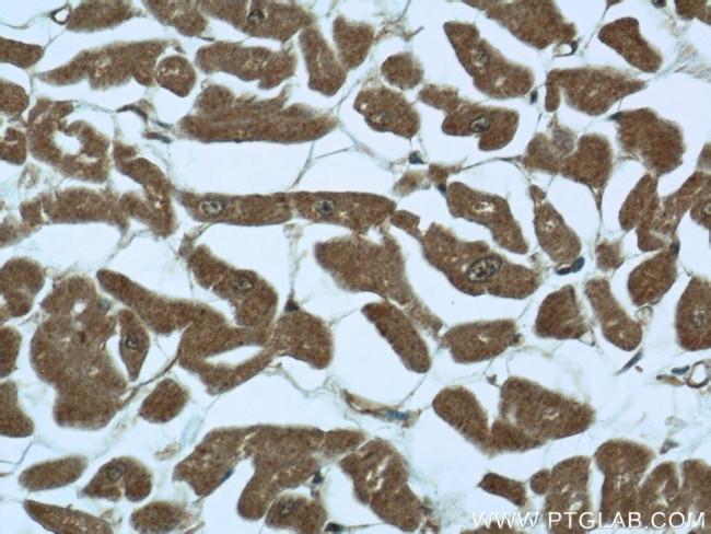 SMAD4 Antibody in Immunohistochemistry (Paraffin) (IHC (P))