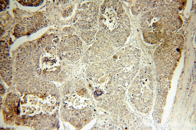 SMAD4 Antibody in Immunohistochemistry (Paraffin) (IHC (P))